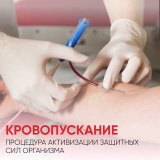 Венозное кровопускание при куперозе и сосудистых з